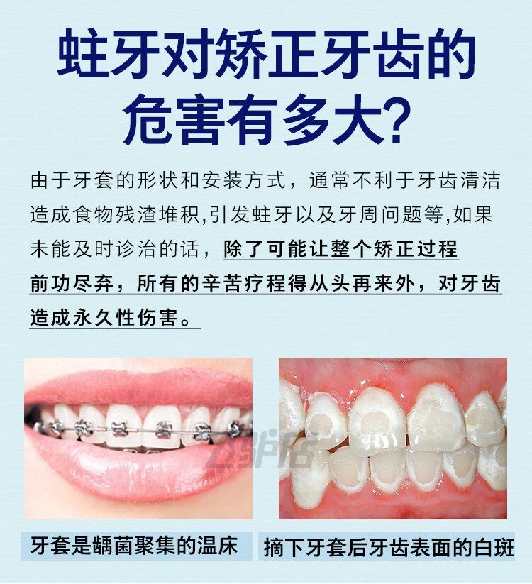 德国进口Colgate高露洁Dentagard牙膏草本薄荷直立按压式100ml详情图1