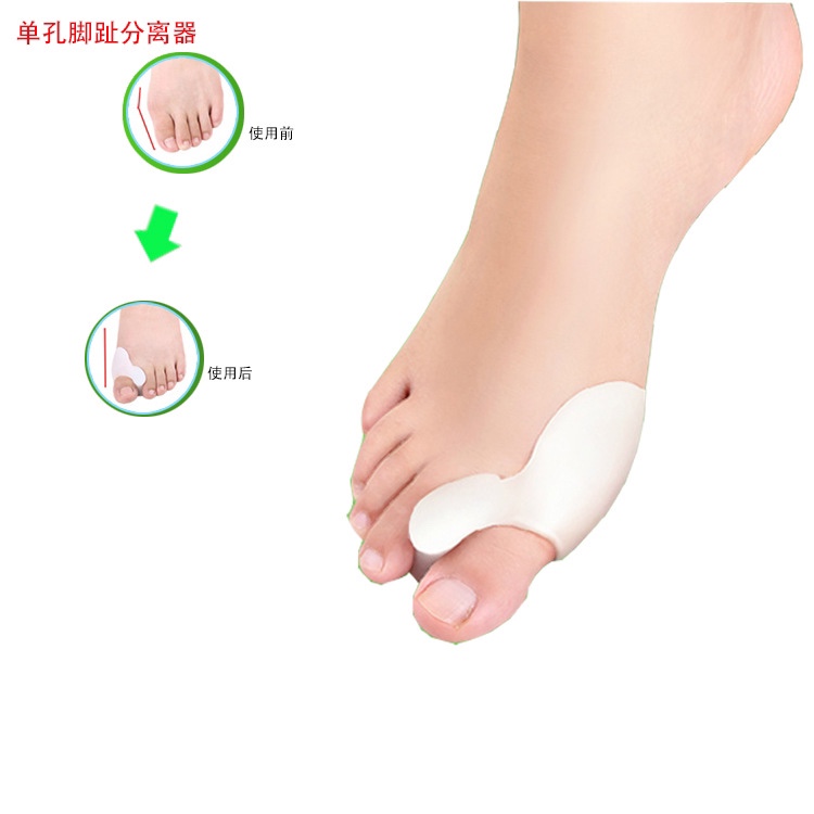 脚趾分离器矫正器大拇趾外翻矫正器分趾器拇囊炎保护套防磨脚详情图1