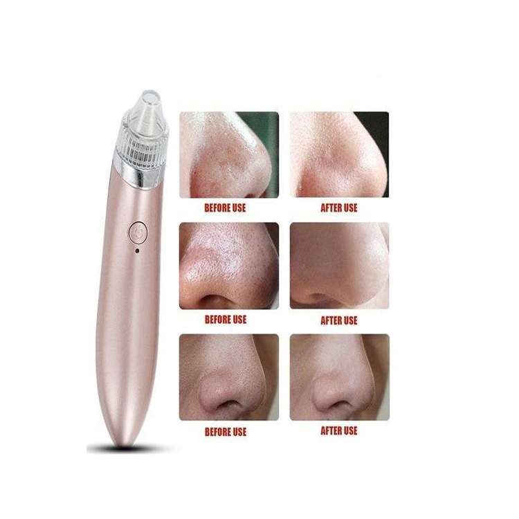 跨境热销电动吸黑头仪器 洁面仪 毛孔清洁器详情图4
