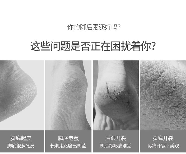 防脚裂护脚套足跟脚跟防干裂神器超薄硅胶脚裂贴脚后跟保护套（20片）详情图3