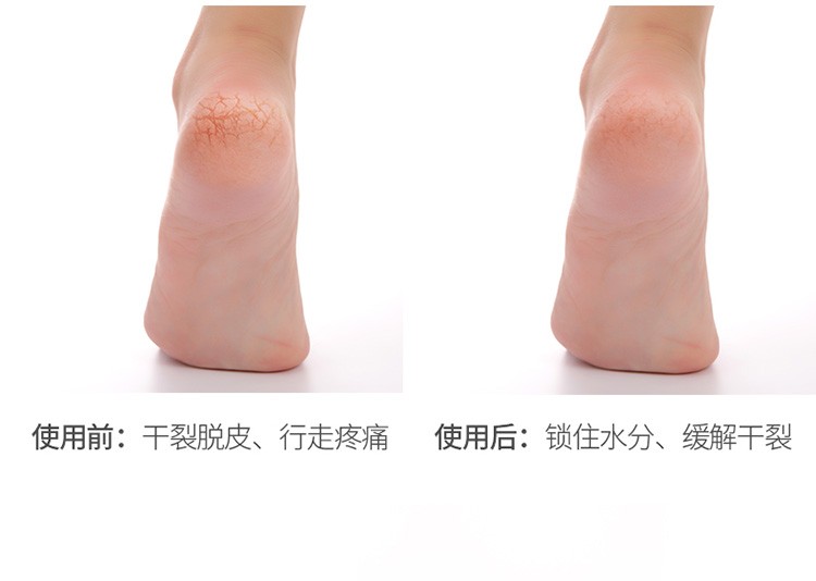 防脚裂护脚套足跟脚跟防干裂神器超薄硅胶脚裂贴脚后跟保护套（20片）详情图4