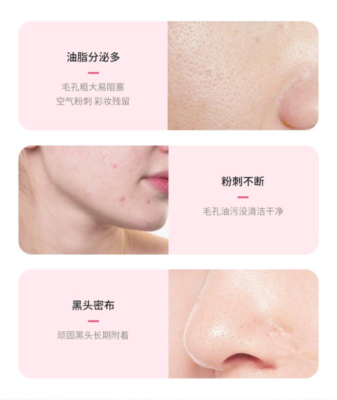 硅胶洁面仪1详情图2
