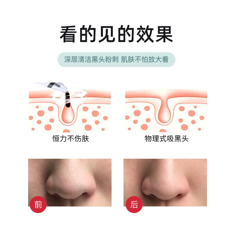 显示屏吸黑头仪器详情图3