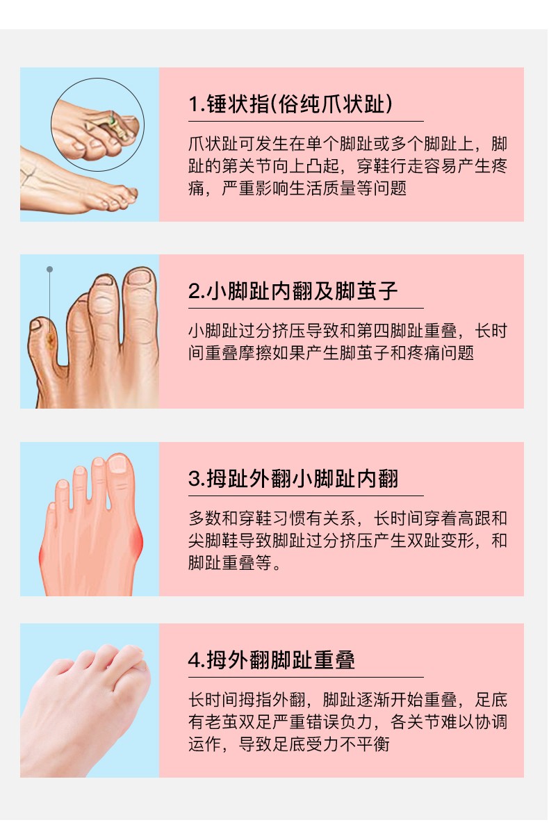 Wholesale insoles, toe rings, toe separators, toe comfort glue separators, toe covers, bunion leg shape correctors, correction rings undefined