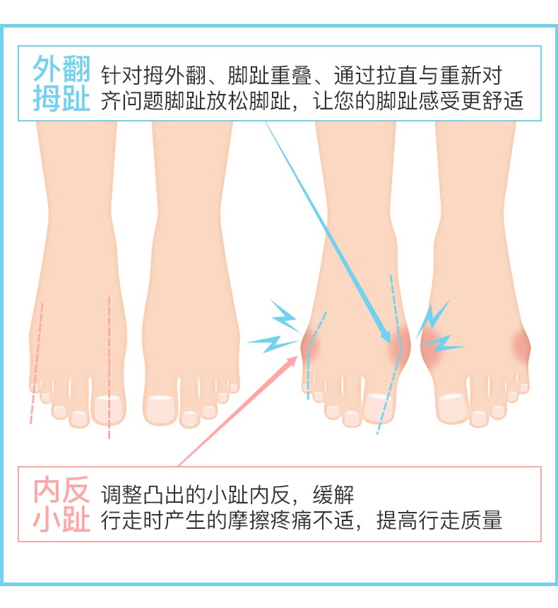 Wholesale insoles, toe rings, toe separators, toe comfort glue separators, toe covers, bunion leg shape correctors, correction rings undefined