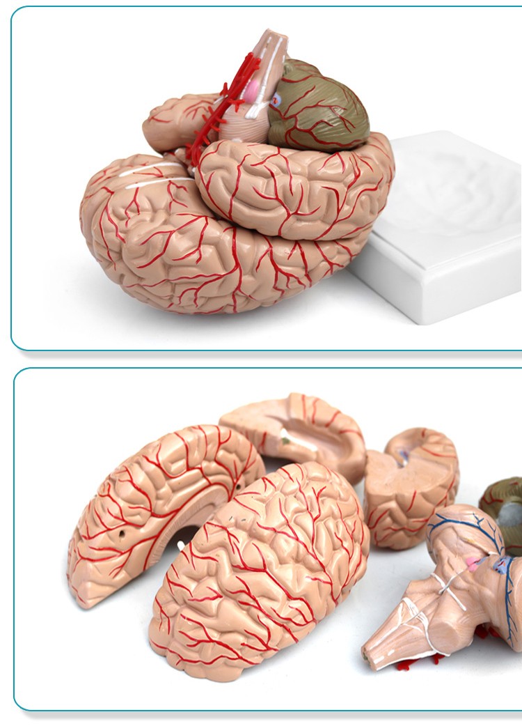 青华 QH3307-10 大脑及动脉模型进口PVC材料生物教学 医学演示详情图3