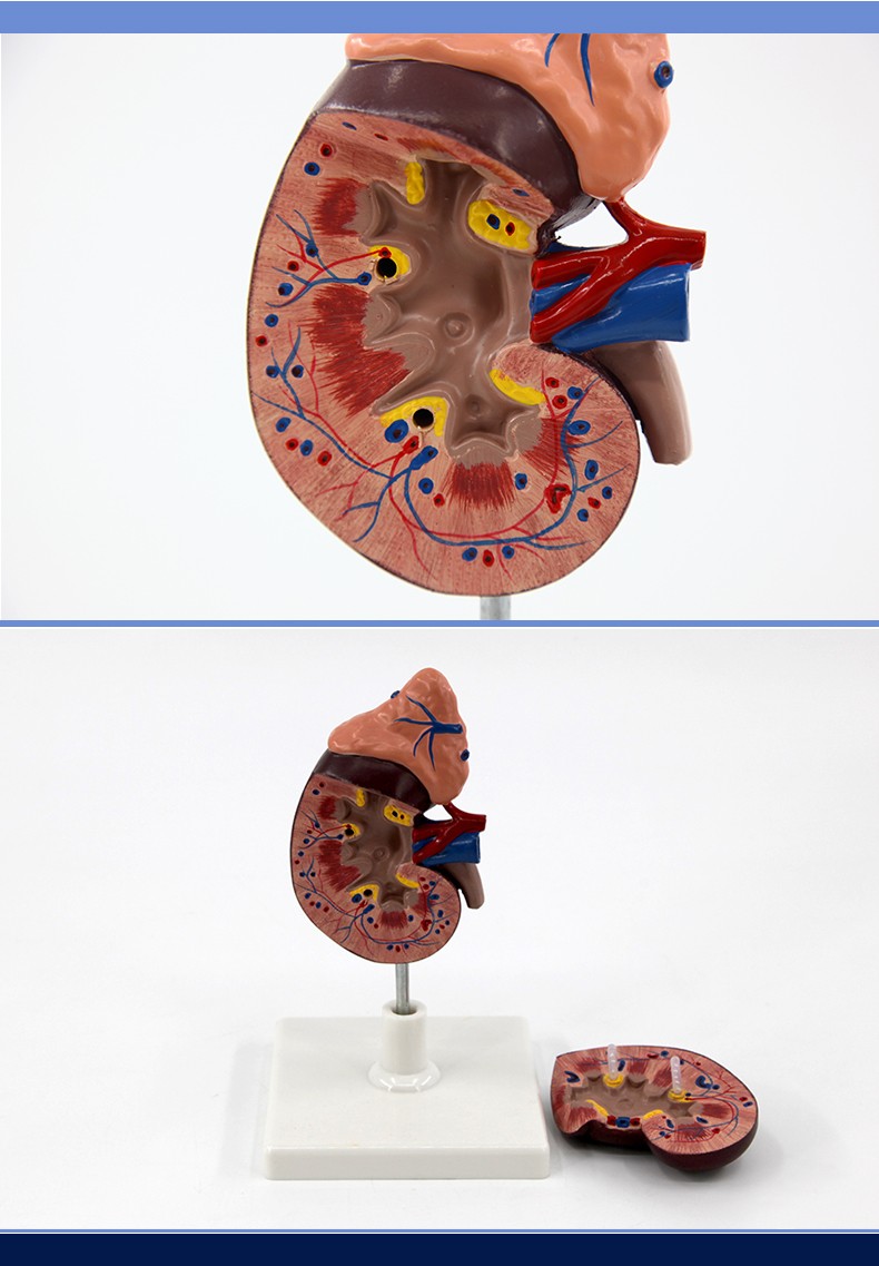 青华 QH3333-1 肾脏模型生物模型 人体脏器解剖模型 教学演示用详情图8