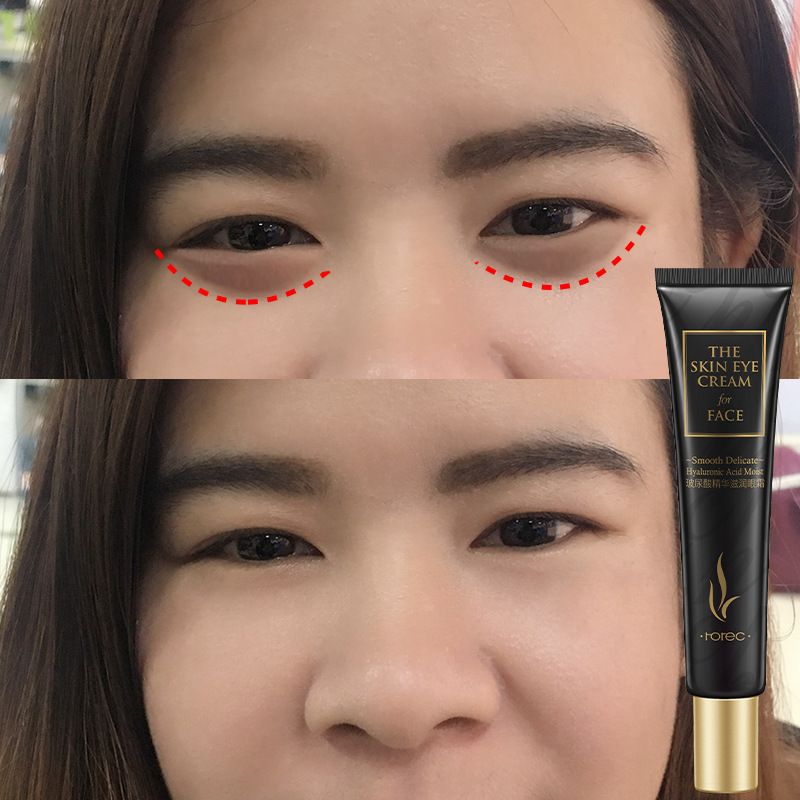 Hanchan Hyaluronic acid essence Moisturizing eye cream moisturizing eye care lifting and tightening eye essence Item Picture