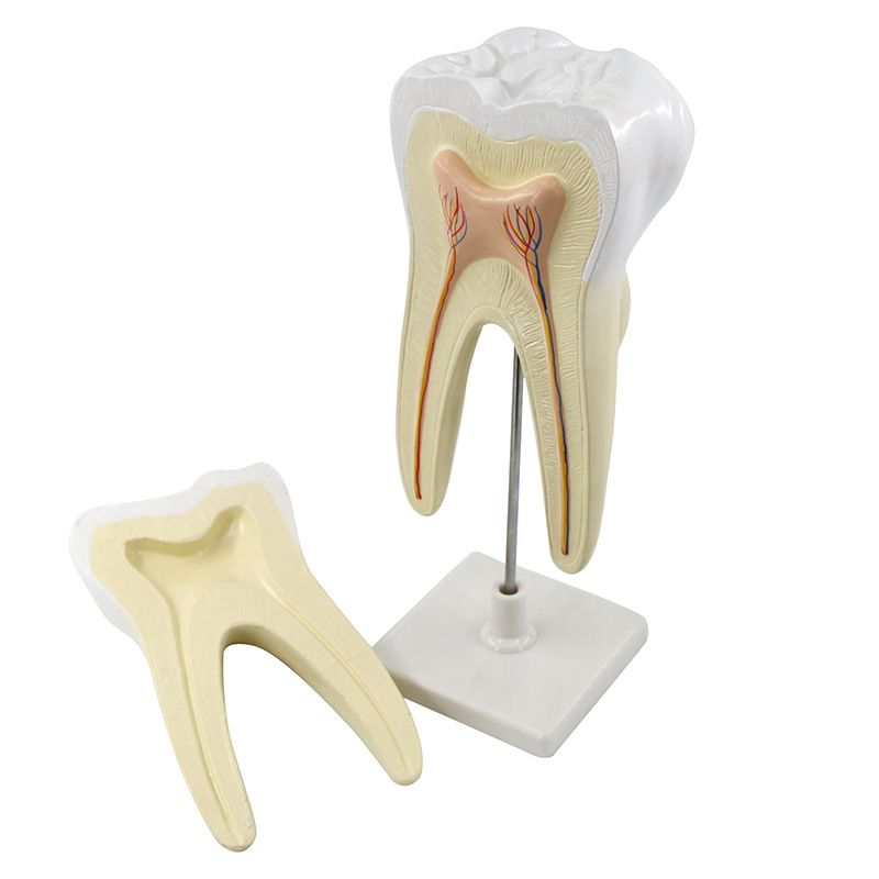 青华臼齿带蛀牙模型 人体牙齿解剖教学生物医学演示详情图3