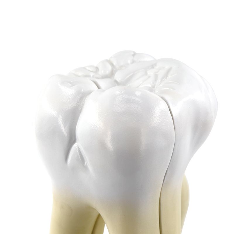 青华臼齿带蛀牙模型 人体牙齿解剖教学生物医学演示详情图5