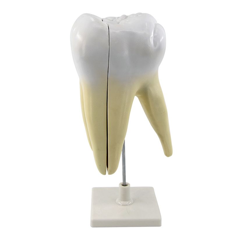 青华臼齿带蛀牙模型 人体牙齿解剖教学生物医学演示详情图4