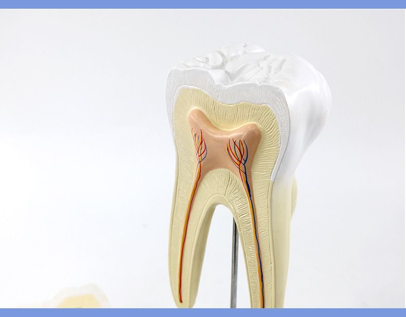 青华臼齿带蛀牙模型 人体牙齿解剖教学生物医学演示详情6