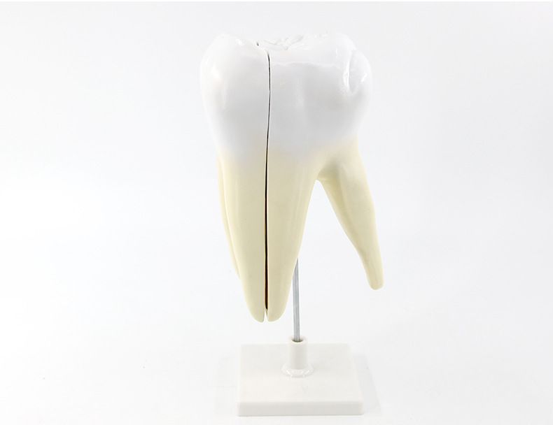 青华臼齿带蛀牙模型 人体牙齿解剖教学生物医学演示详情5