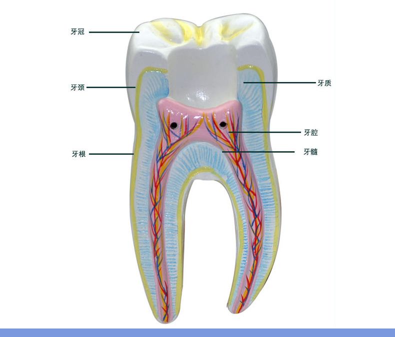 青华臼齿带蛀牙模型 人体牙齿解剖教学生物医学演示详情9