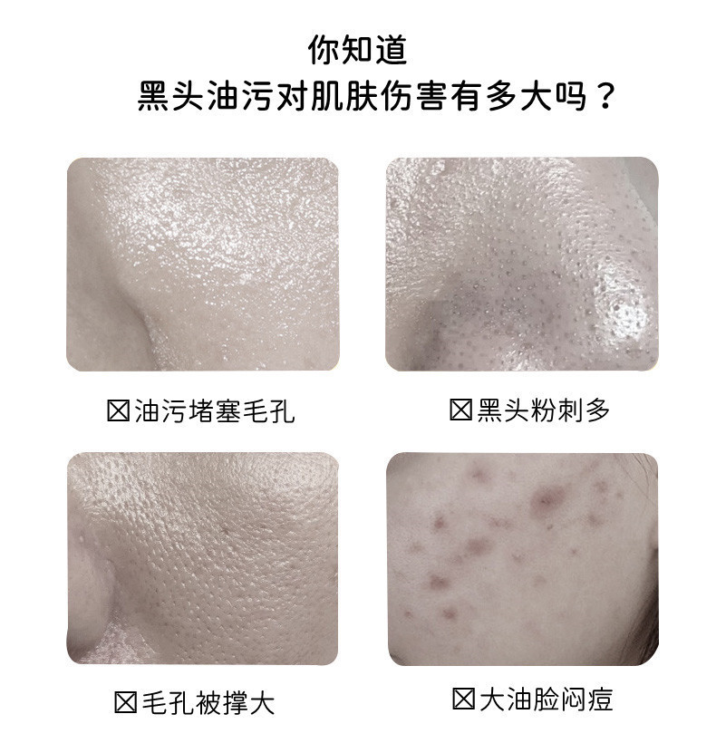 Dear She炫彩撕拉面膜蓝  去黑头去粉刺 详情2