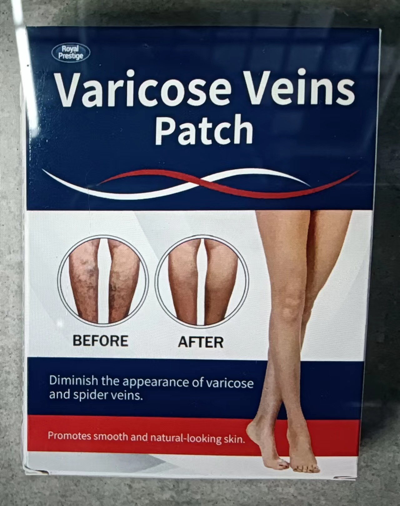 Venous patch pic 1