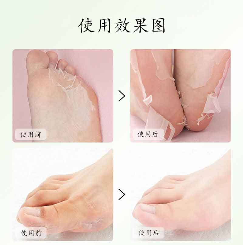 ALIVER 芦荟去死皮足膜  去角质足膜脚膜单片装详情7