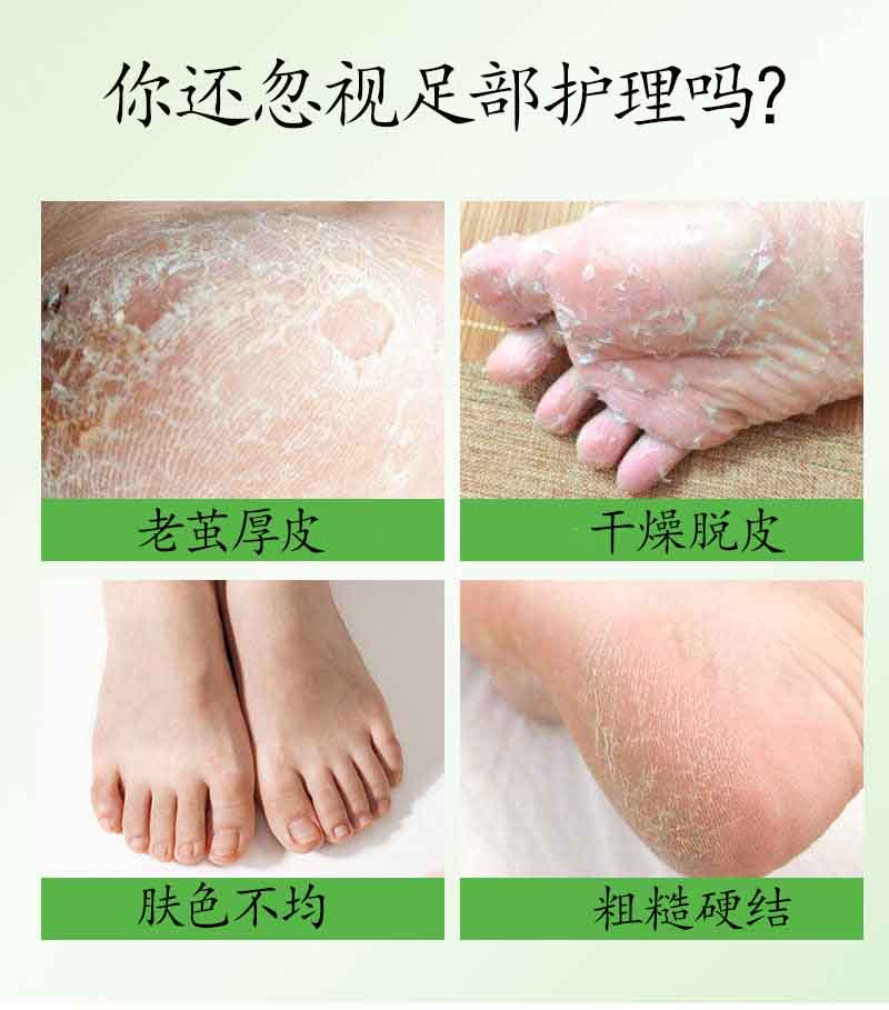 ALIVER 芦荟去死皮足膜  去角质足膜脚膜单片装详情2