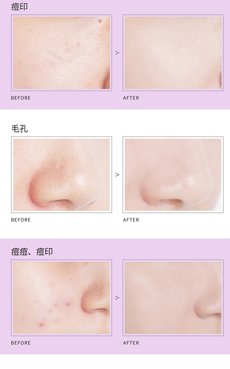 美茜儿遮瑕膏遮盖斑点淡化纹身遮雀斑痘印黑眼圈防水持久淡化眼袋详情4