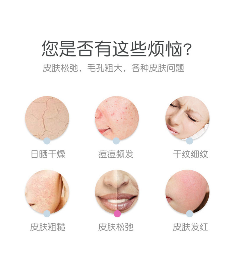 面部美妆按摩硅胶敷脸冰格毛孔猫爪冰块ice roller冷热冰敷脸巾详情13