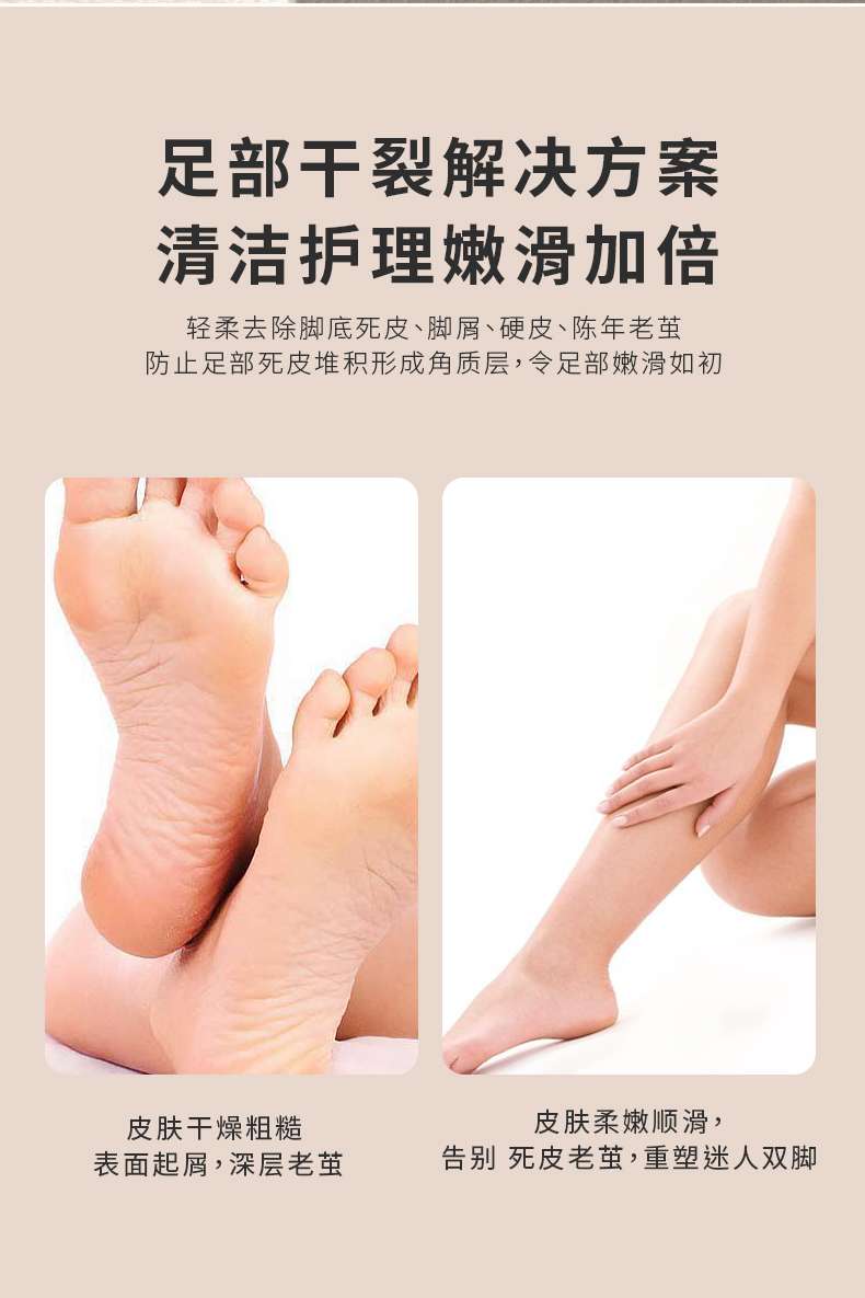 New Electric Foot Grinder To Remove Dead Skin And Calluses Beauty Foot Rechargeable Electric Pedicure Home Pedicure Magic undefined