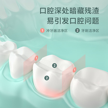 映趣2022新款高效清洁牙齿清洁牙菌高颜值冲牙器