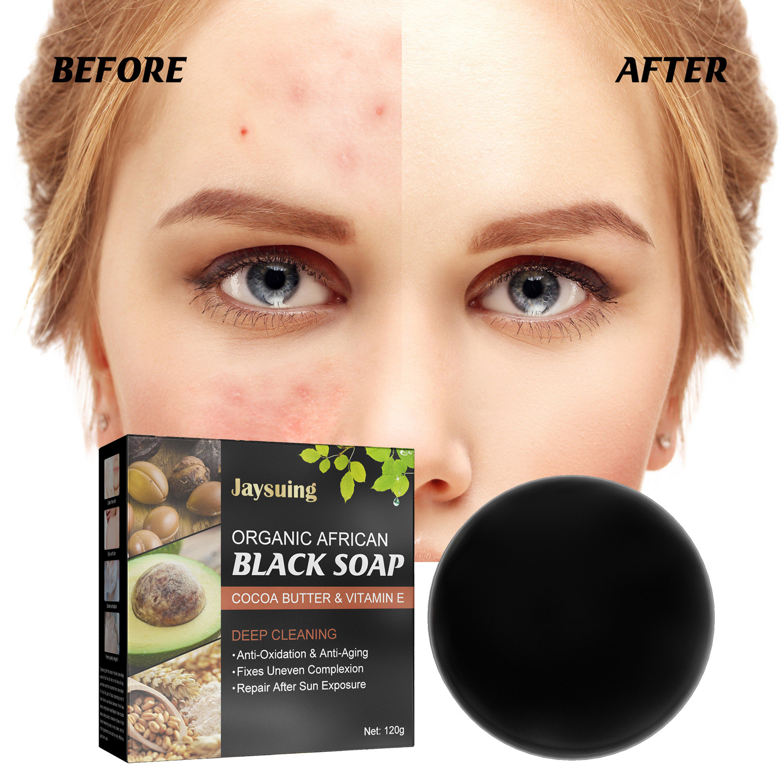 Acne-removing mite beauty soap Facial Facial cleaning anti-acne Back cleaning acne-removing mite Manual YL075-cmz217yx01-120g full figure