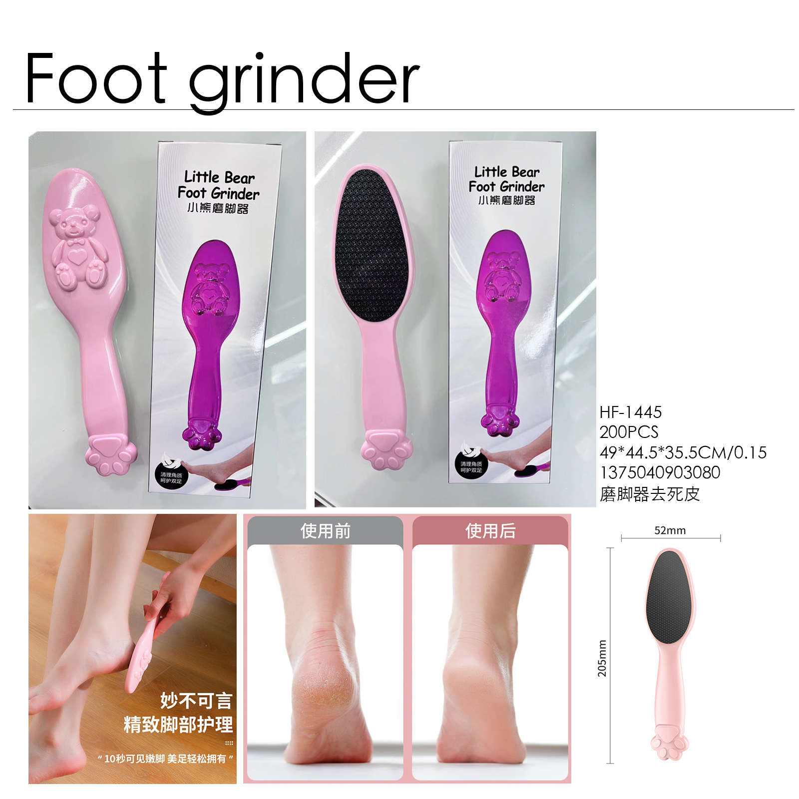 Pedicure afilador de pies Application Scenario