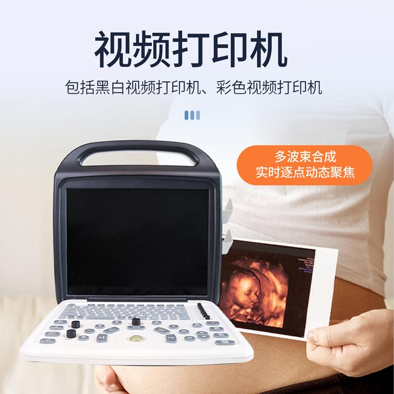 up8 people use ultrasonic diagnostic machine wireless lithium battery operating room portable open color ultrasonic diagnostic machine