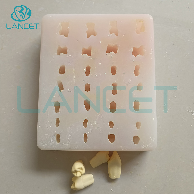 2倍石膏牙阴模（不带底座）
