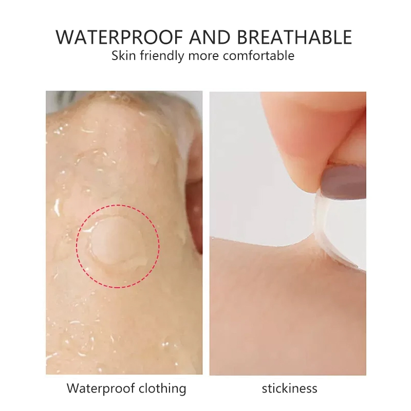 Skpradis Acne Cover Patch Skpradis Acne Cover Patch Application Scenario