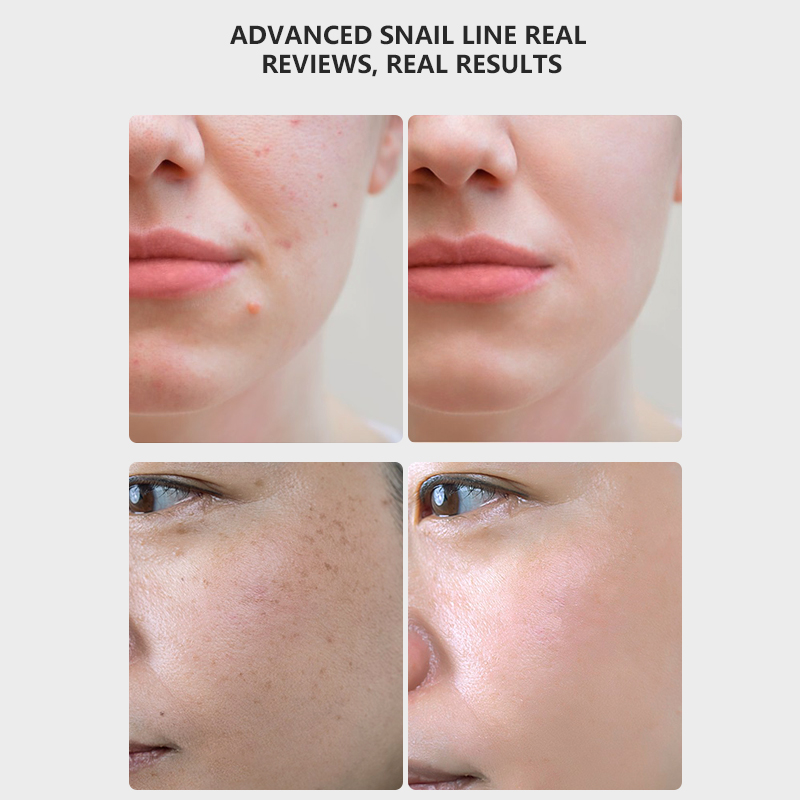 Skpradis Advanced Snail 96 Mucin Power Essence. Skpradis Advanced Snail 96 Mucin Power Essence Specification drawing