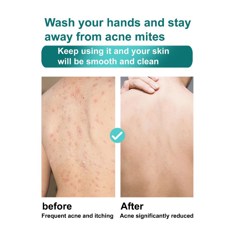 ROUSHUN 柔顺VC磨砂沐浴露 Vitamin C Scrub Shower Gel详情4