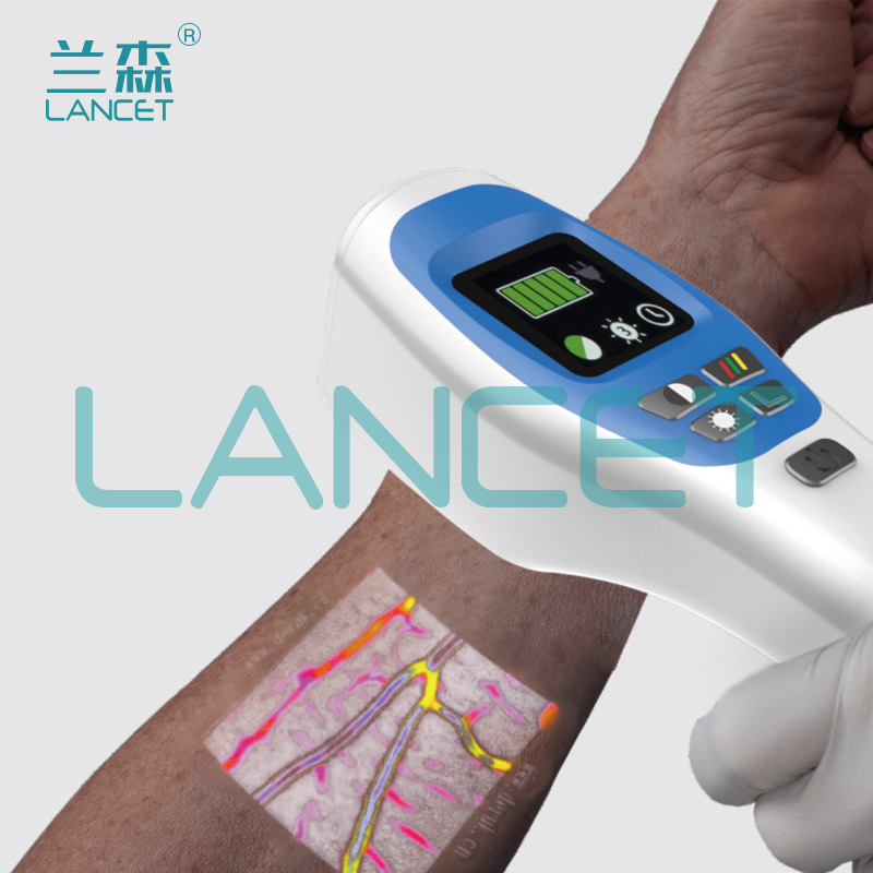 vein finder 血管显像仪静脉血管显像仪静脉显示仪新款详情2