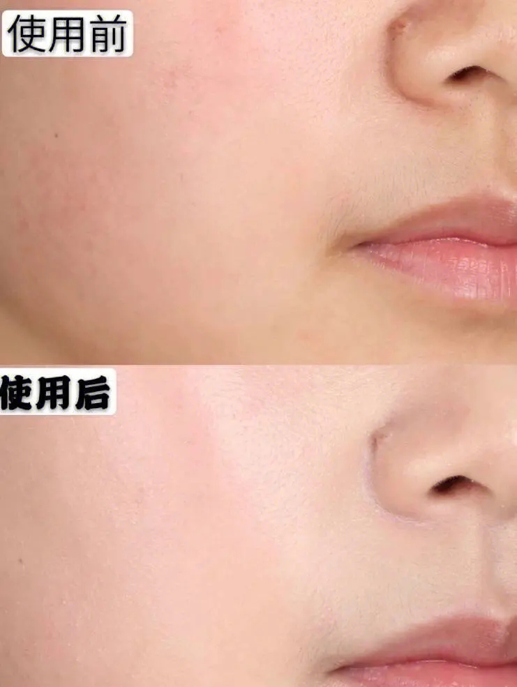 包邮! PROTEZIONE进口美妆台湾森田玻尿酸复合原液面膜详情10