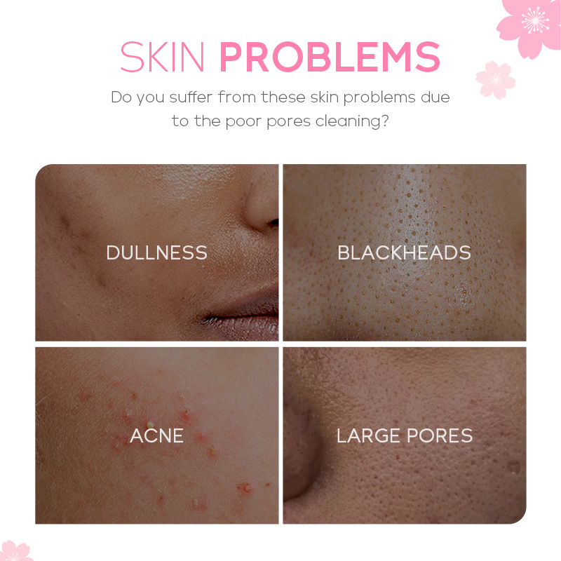 Cross-border fenyi Cherry Blossom solid Mask Stick application type mask for pore cleansing, hydration and moisturizing manufacturer wholesale Application Scenario