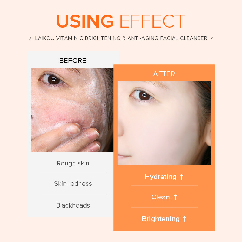 LAIKOU Vitamin C Facial Cleanser 40g (Color box) Skin care facial Cleanser one-piece consignment manufacturer Application Scenario