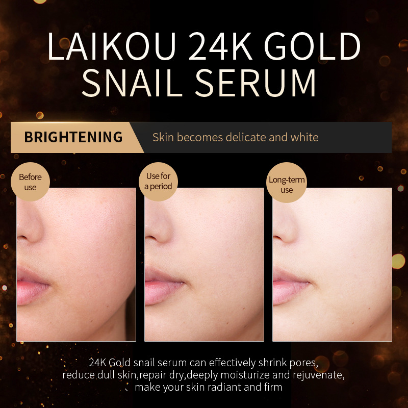 Laikou French 24k Golden Snail Essence 100ml Skin Care Product manufacturer Supply Hydrating and Moisturizing Essence wholesale Application Scenario