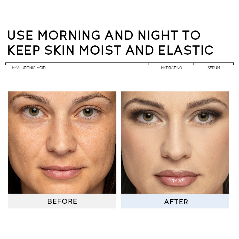 Cross-border QUIYUM Hyaluronic acid Essence, 17ml Hydrating, Moisturizing and Brightening Essence, factory wholesale in stock details Picture