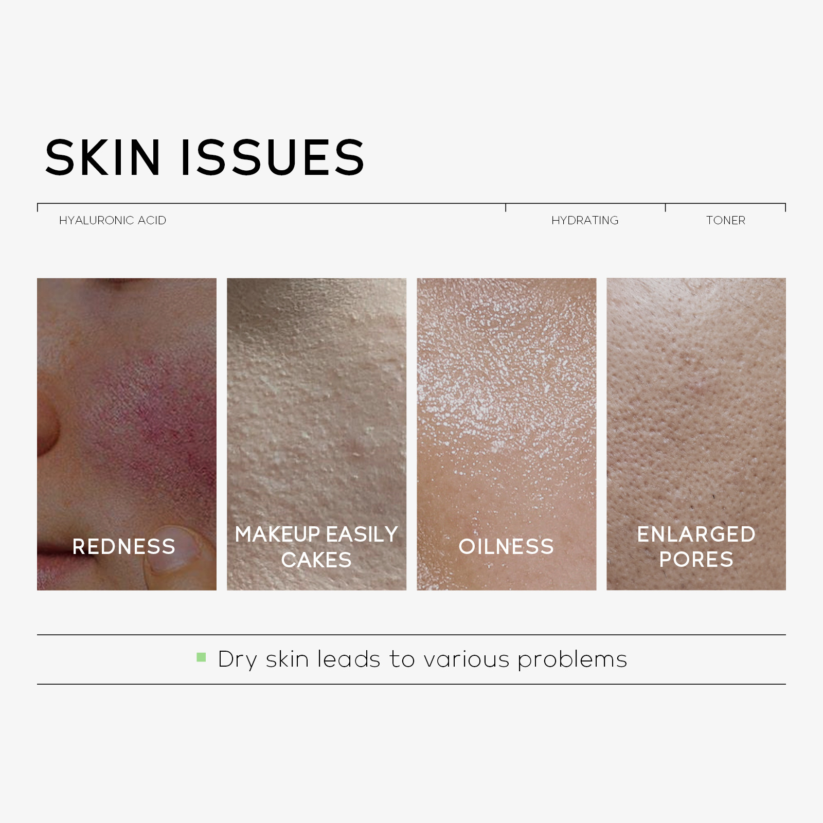 QUIYUM Hyaluronic Acid Toner 100ml Hydrates, moisturizes, nourishes and refines pores. Factory in stock, one-piece consignment details Picture