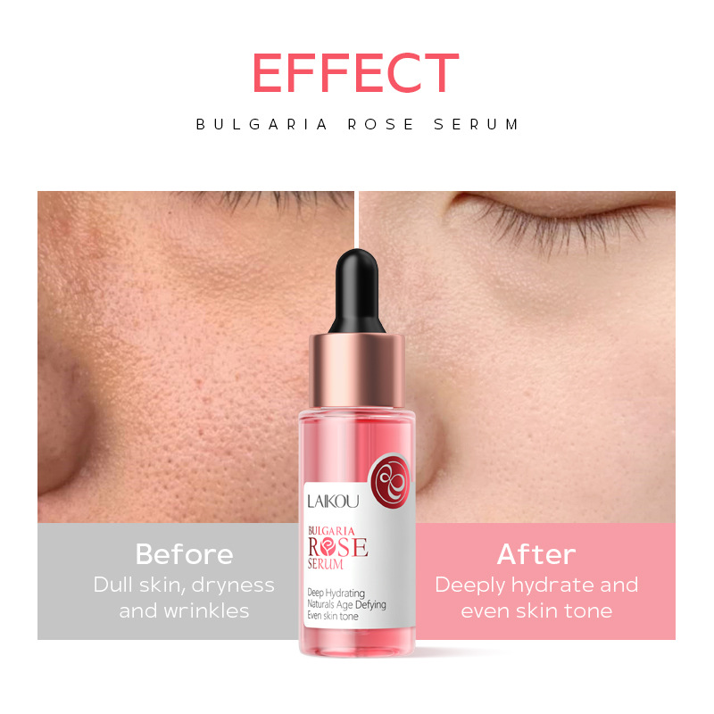 LAIKOU Rose Essence 30ml Hydrating, moisturizing and nourishing skin Facial care essence manufacturer in stock wholesale Application Scenario