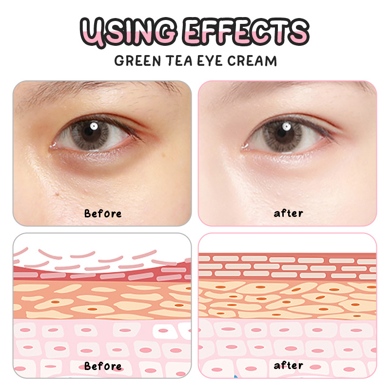 Cross-border fenyi Green Tea Eye Cream 20g Indonesian Version Hydrating, Moisturizing, Nourishing and improving eye Bags Manufacturer in stock details Picture