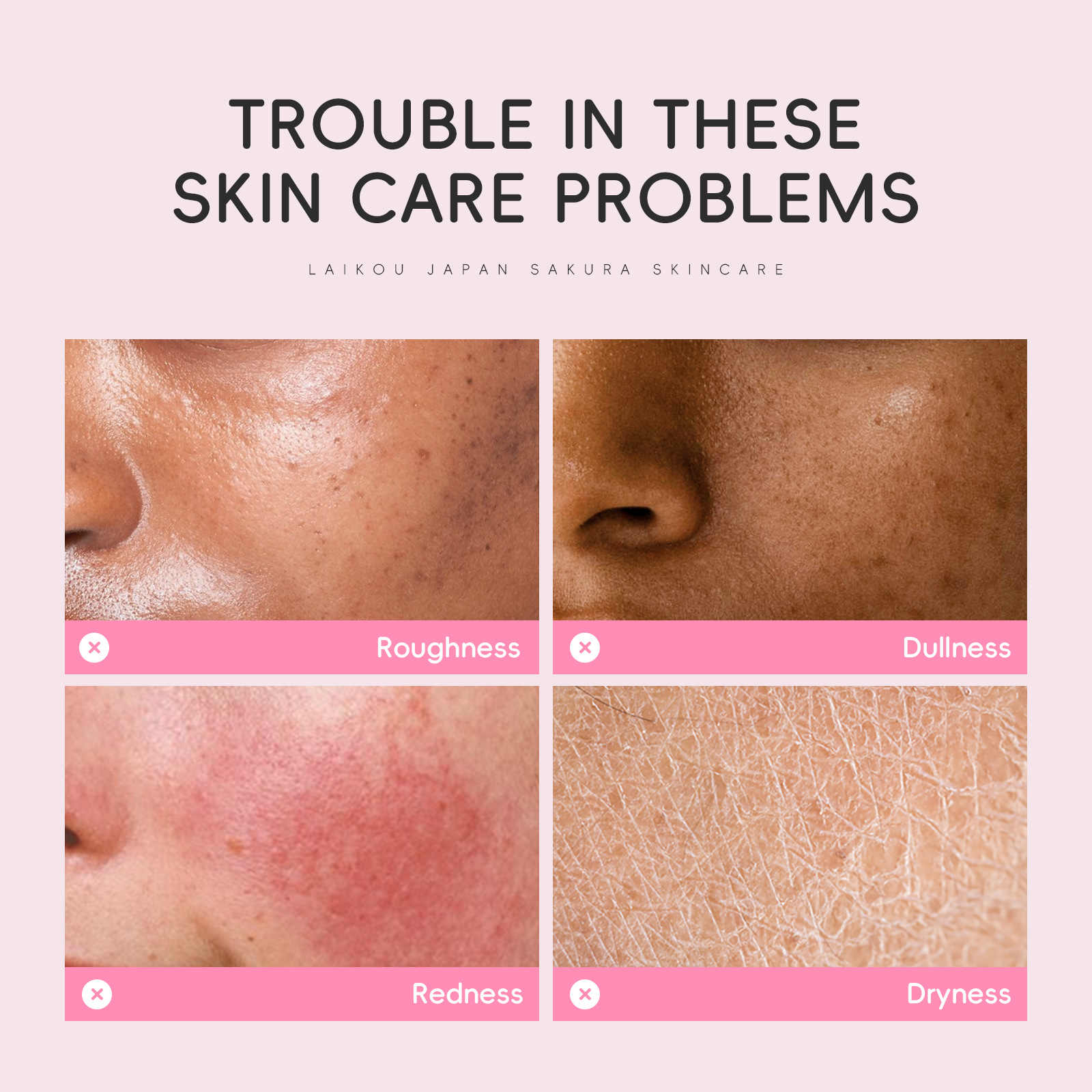 LAIKOU Cherry Blossom Toner 160ml Upgraded Large bottle Cross-border fda skin care product in English packaging details Picture