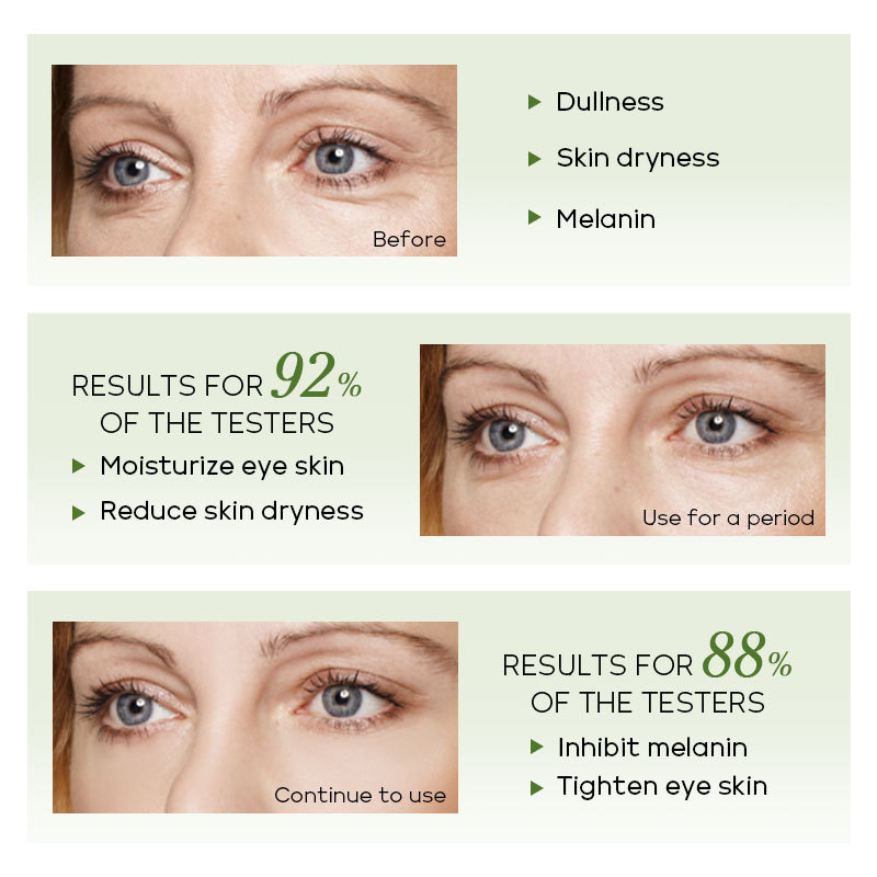 FENYI Green Tea Eye Serum 15ml Hydrates, Moisturizes, cares for and nourishes the skin around the eyes. Cross-border manufacturer details Picture