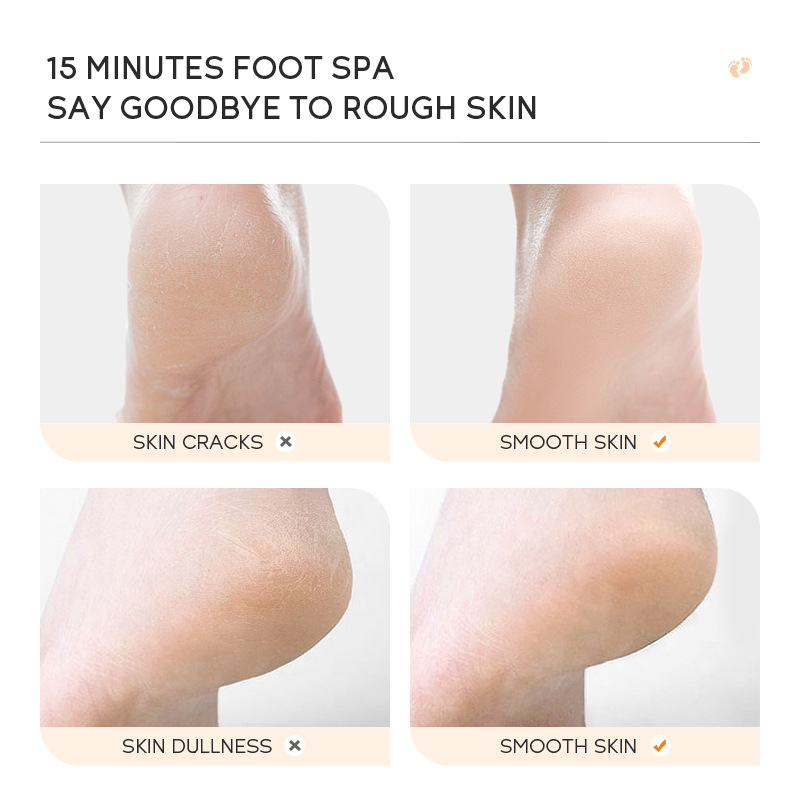 Cross-border QUIYUM milk and honey peel-off foot wax e foot care keratin manufacturer's wholesale in stock Application Scenario