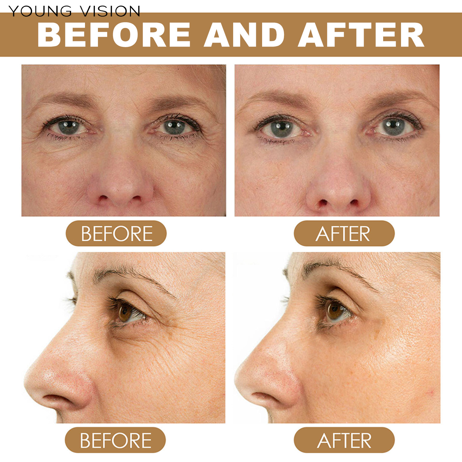 YOUNG VISION Retinol Eye Cream Bar Application Scenario