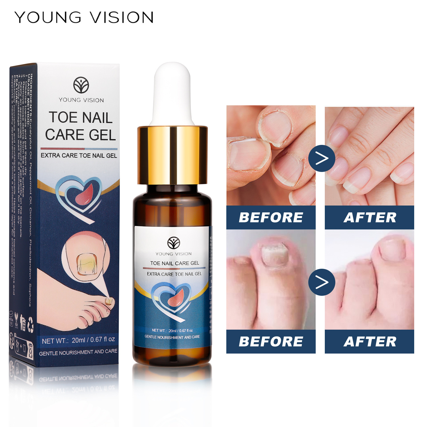 YOUNG VISION Toenail essential oil full figure