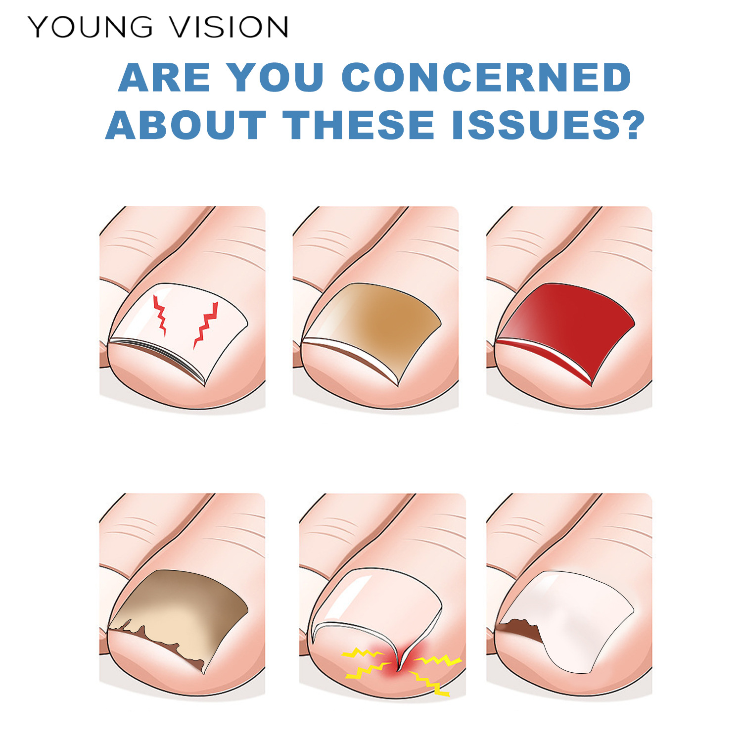 YOUNG VISION Toenail patch details Picture
