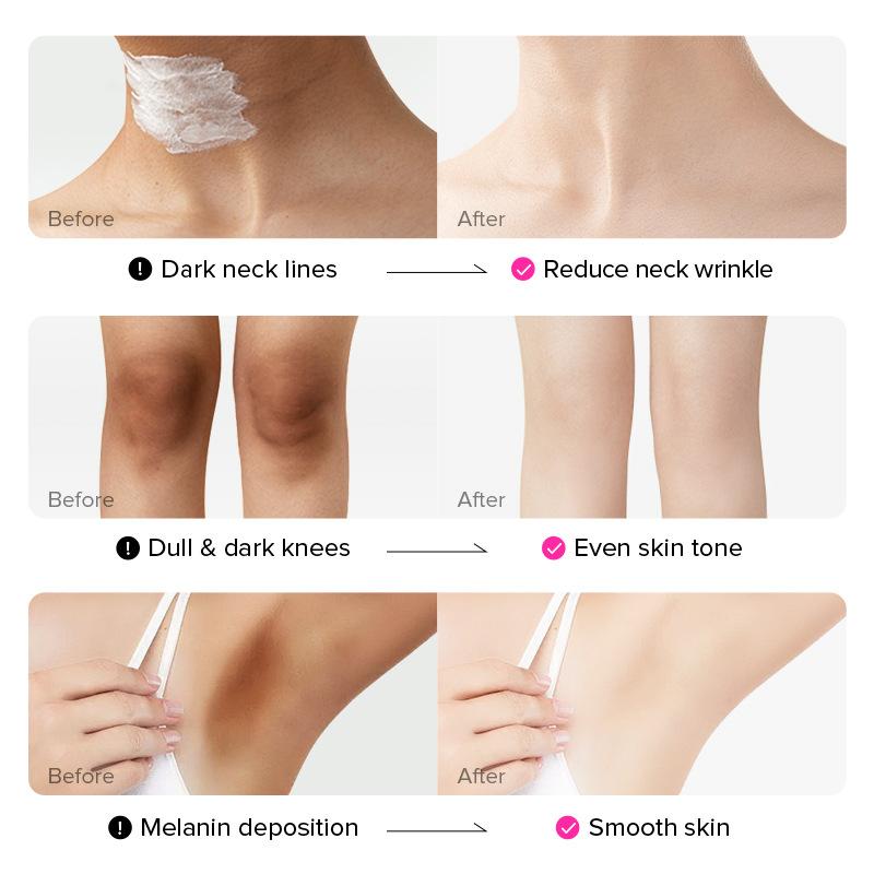 LAIKOU cream 100g Hydrating and moisturizing Underarm Cream Facial skin care products cross-border Specification drawing