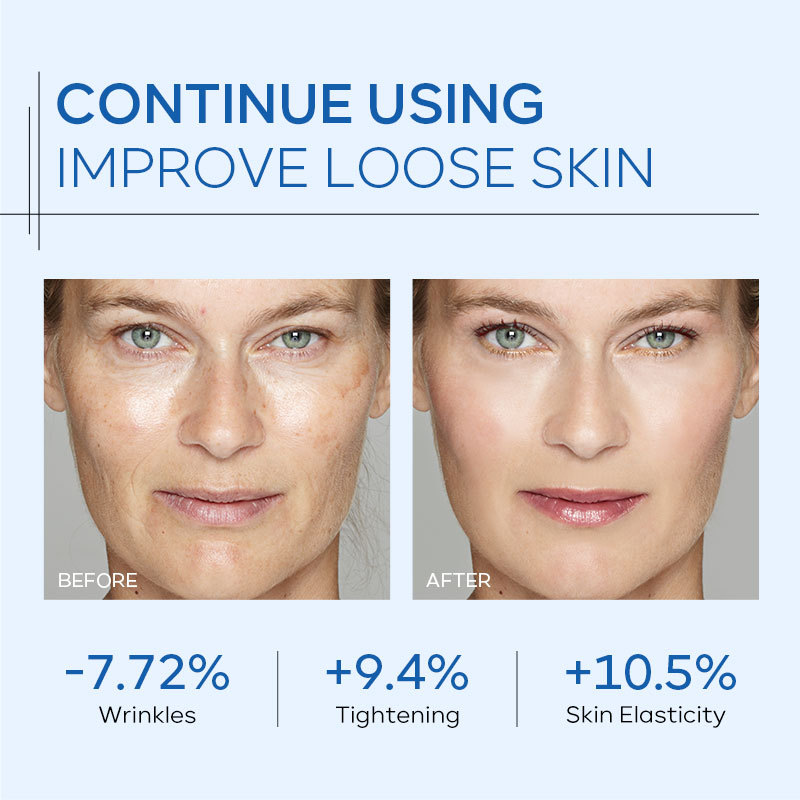 Manufacturer's in-stock cross-border QUIYUM Collagen Moisturizing Cream 30g hydrating and moisturizing cream Application Scenario